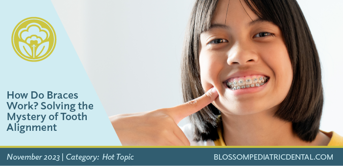 How Do Braces Work? Solving the Mystery of Tooth Alignment - Blossom Dental